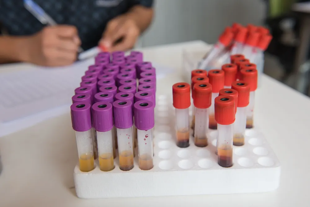 Khoa học đột phá gặp sự hoài nghi của thị trường: Insight Molecular Diagnostics Inc. (IMDX) - Thời điểm định đoạt