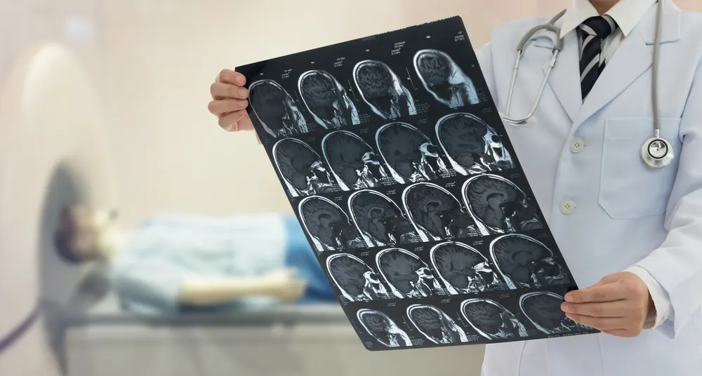 Neuronetics (STIM) tham dự Hội nghị Mind, Muscle & Vision
