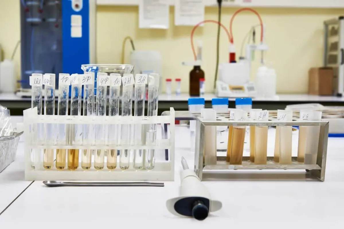 Cổ phiếu Labcorp Holdings có đang hoạt động kém hơn Nasdaq?