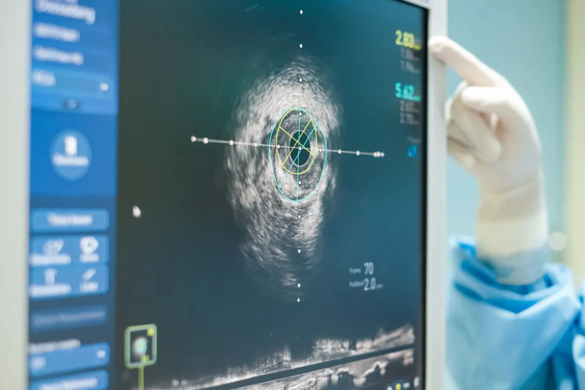 Cổ phiếu IQVIA (IQV): Kỳ vọng gì từ báo cáo Q2/2026?