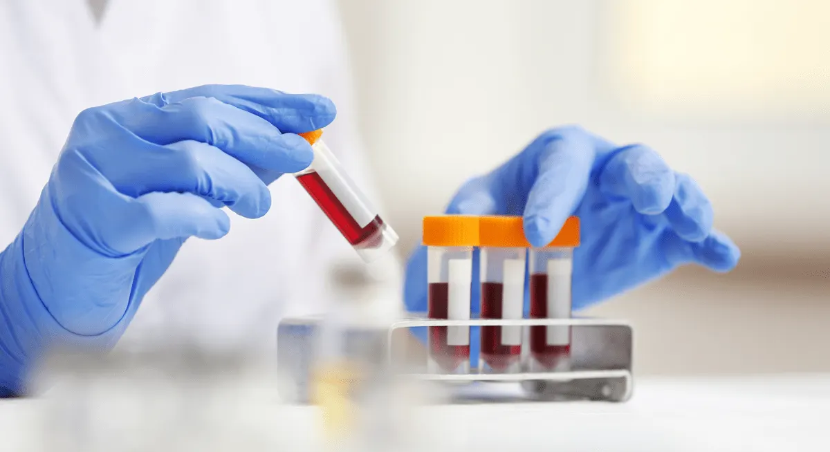 Kala Bio độc quyền phân phối xét nghiệm gen nhãn khoa Virotek tại Mỹ